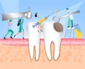 Medical examination and diagnosis of the tooth affected by caries. Enamel damage, tooth infection, bacteria. Dentistry, treatment